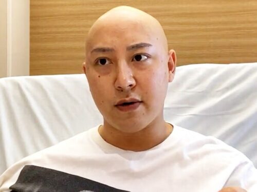 ステージ 3 の精巣がん患者の今後の見通しはどうなりますか?